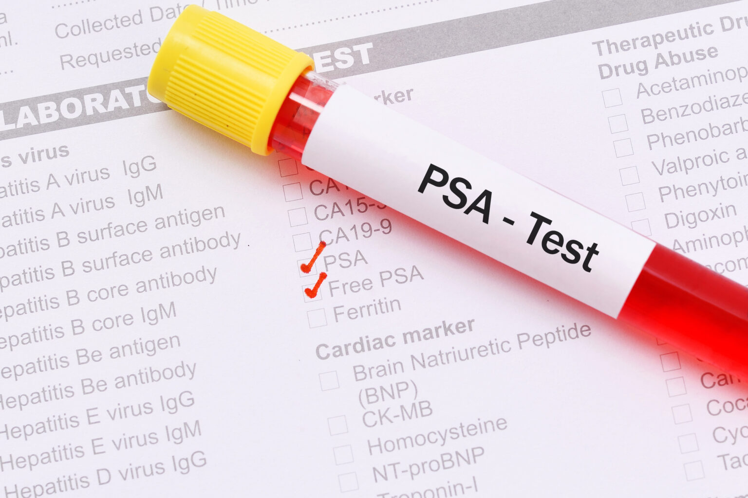 What Psa Level Indicates Cancer